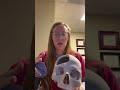 Hemicraniectomy - a life saving procedure to remove part of the skull to relieve brain swelling.
