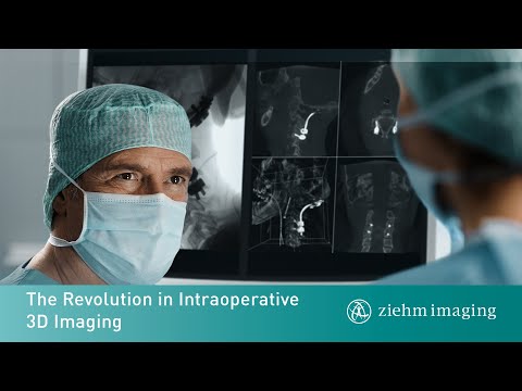 Ziehm Imaging Vision RFD 3D Product Trailer