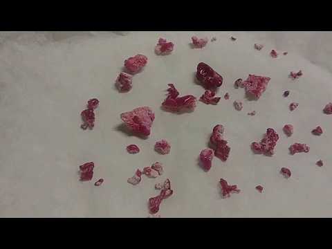 Homemade Synthetic Ruby/Corundum Update. (Verneuil Process / Flame Fusion)