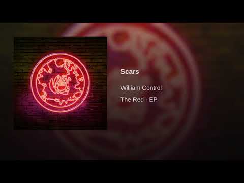 Video thumbnail for Scars