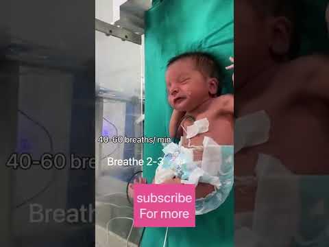 How to give bag & mask ventilation #newborn #shorts #pediatrics | the baby doctor