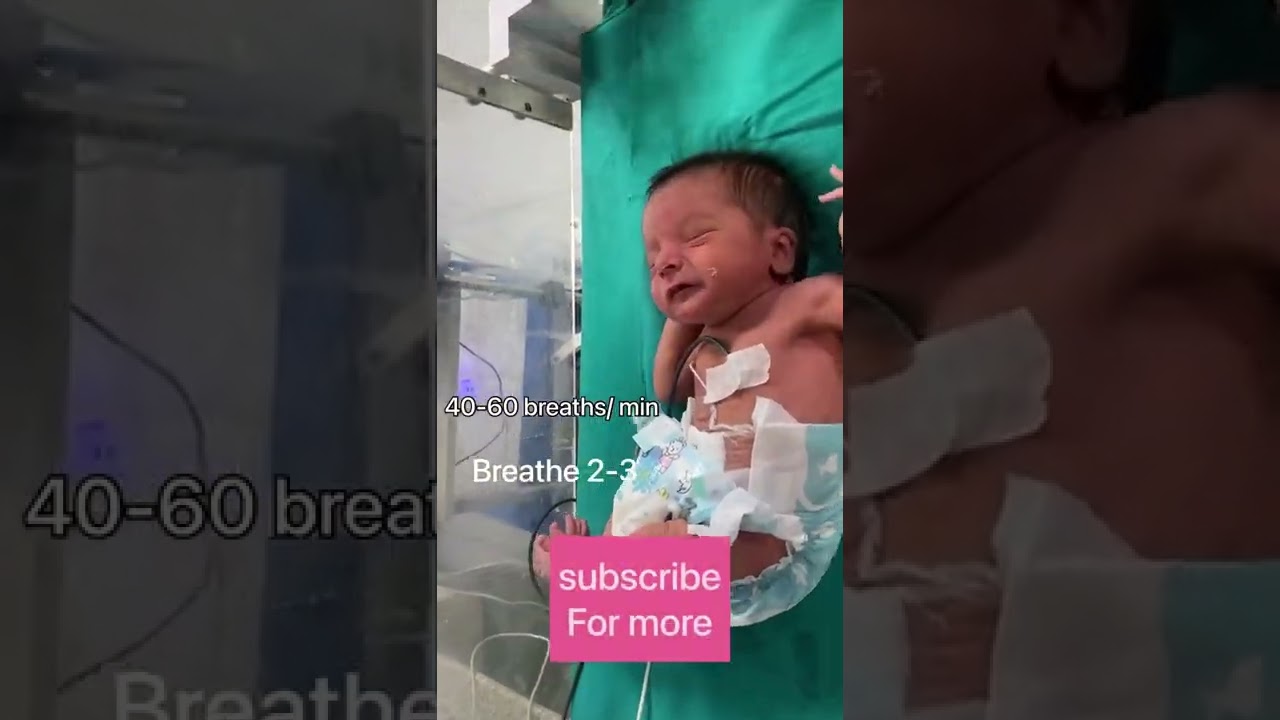 How to give bag & mask ventilation #newborn #shorts #pediatrics | the baby doctor