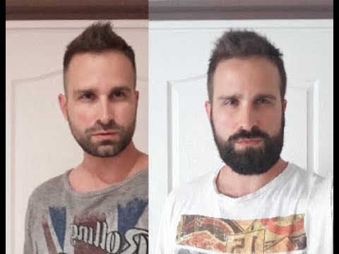 2 months Beard Challenge