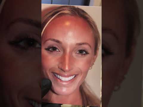 Patient video testimonial