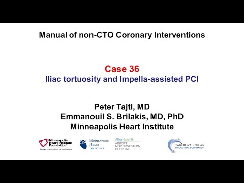 Case 36: PCI Manual - Challenges with Impella-assisted PCI