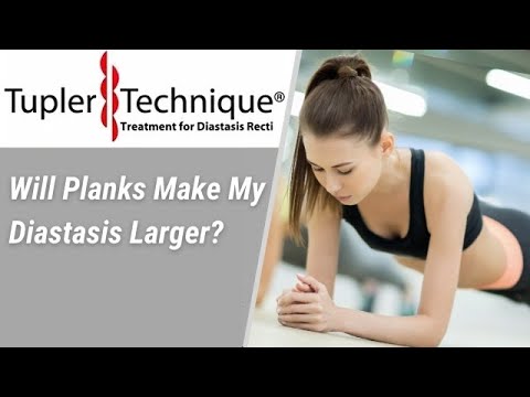 Will Planks Make My Diastasis Larger?