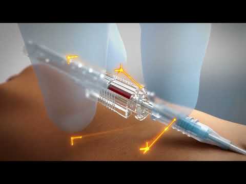 ClearSafe Comfort® Safety IV Catheters
