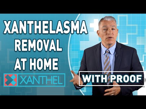 Xanthelasma Removal At Home