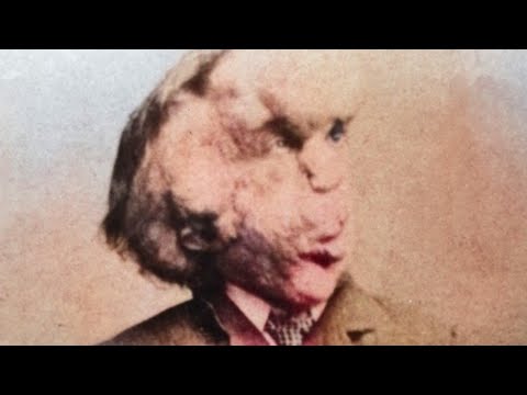 How The Elephant Man, Joseph Merrick, Really Died