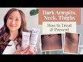 Treating And Preventing Dark Armpits Thighs Neck And Arms Dr Jenny Liu