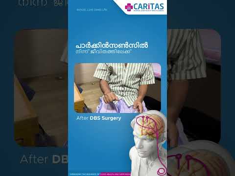 Parkinsonism Treatment