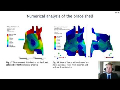 Numerical analysis of scoliosis brace