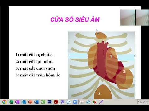 Các mặt cắt trong siêu âm tim Các mặt cắt trong siêu âm tim