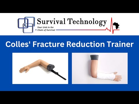 Colles' Fracture
