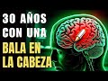 HISTORIA REAL ViVir 30 Años Con Una BaLa En La CabezA