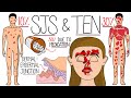 Understanding Stevens-Johnson Syndrome and Toxic Epidermal Necrolysis (SJS & TEN)