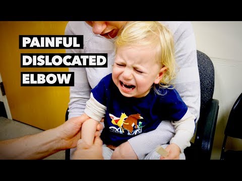 PAINFUL DISLOCATED ELBOW (nursemaids elbow) | Dr. Paul