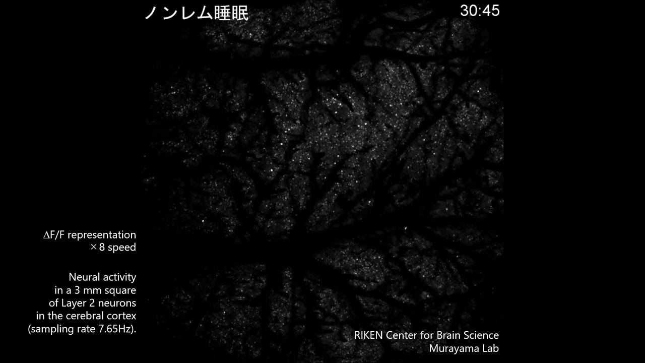 マウスの覚醒－睡眠中の大規模神経活動記録