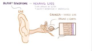 Alport syndrome causes, symptoms, diagnosis, treatment & pathology