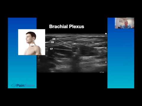 Ultrasound Guided Interscalene Brachial Plexus Block- Regional Anesthesia & Chronic Pain Indications
