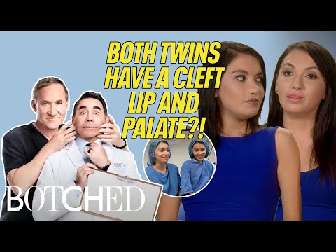 Twins Magali and Cynthia BOTH Have Cleft Lips And Palates?! (Before & After) | Botched | E!