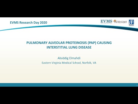 Thumbnail image of video presentation for Pulmonary alveolar proteinosis (PAP) causing interstitial lung disease