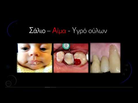Απομόνωση χωρίς την χρήση Ελαστικού Απομονωτήρα. (Dental TTT - Webinar No 40).