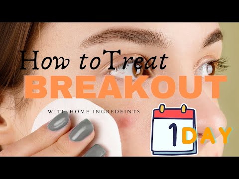 How To Get Rid of Acne in 1 Day