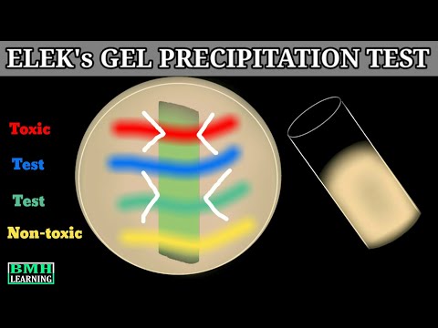 Elek's Gel Precipitation Test | Elek' Test | Corynebacterium Diptheriae Gel Precipitation Test |