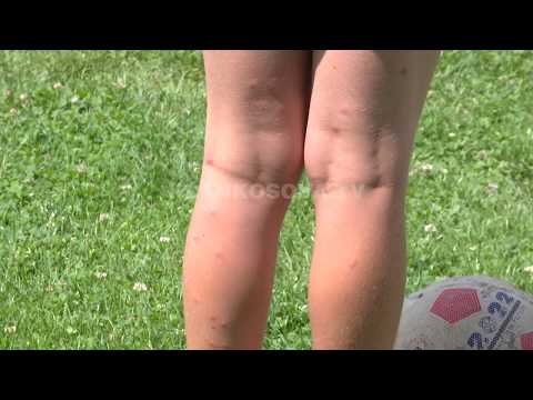 Në Bresalc, pleshtat terrorizojnë banorët - 19.06.2018 - Klan Kosova