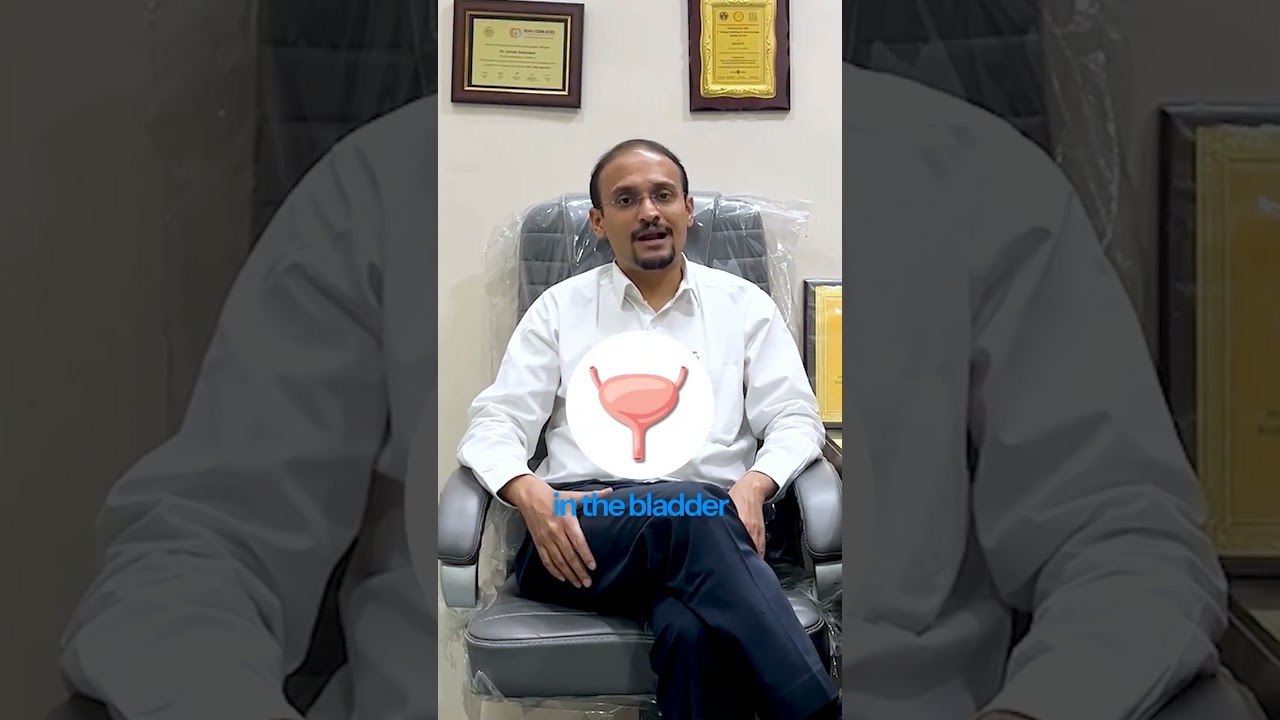 Bladder cancer - non muscle invasive cancer management
