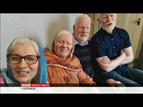 South Asian family from the UK wins Guinness World Record for most albino siblings.