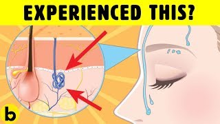 7 Signs Of Vitamin D Deficiency