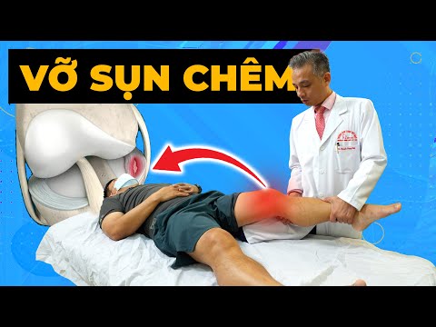 VỠ SỤN CHÊM: Khi Nào CẦN Phẫu Thuật? - Bác Sĩ Thể Thao Hướng Dẫn Điều Trị