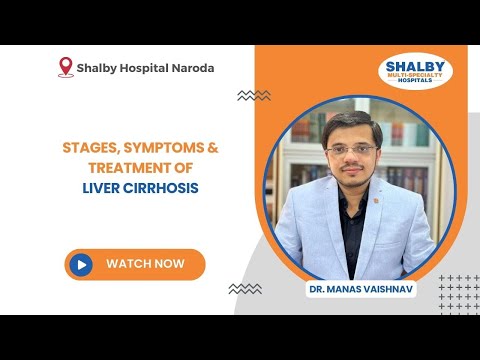 Stages, Symptoms & Treatment of Liver Cirrhosis