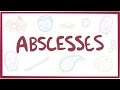 Abscesses - causes, symptoms, diagnosis, treatment, pathology
