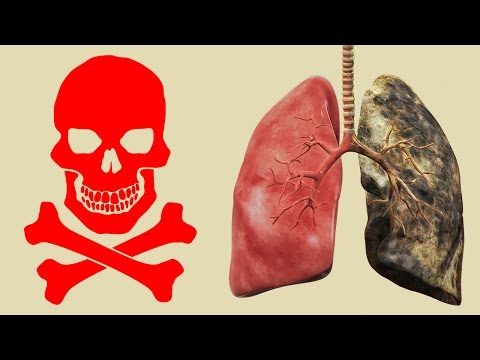 Schmerzmittel für Prostata Medizinische Kerzen vitaprost forte