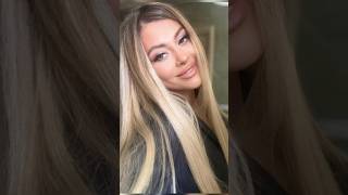 Aygün Kazımovanın Qızı Tanınmaz Halda.