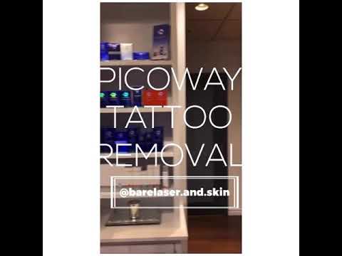 FRASER HEIGHTS SURREY #1 Laser Tattoo Removal @ Bare Laser and Skin using THE PICOWAY