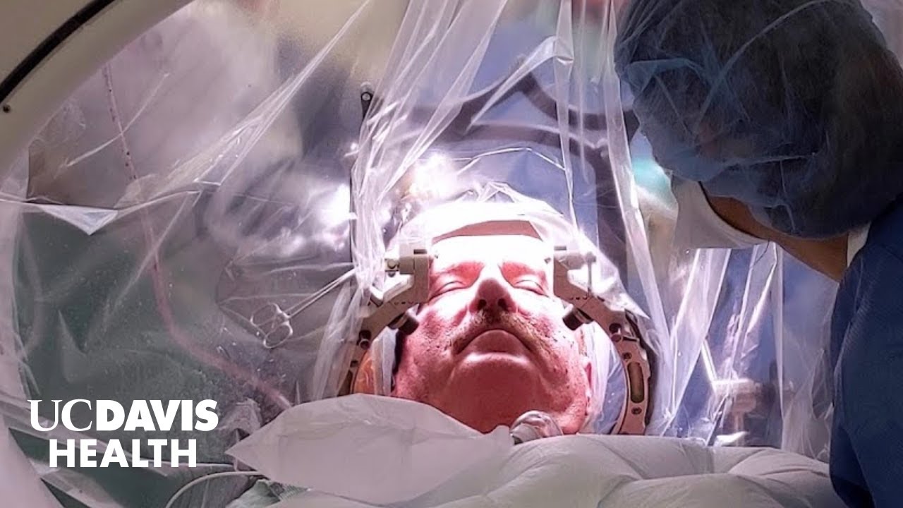 Thumbnail preview of Robotic Neurosurgery at UC Davis Health — The First Comprehensive Program in the Region