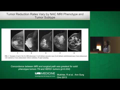 download lagu mp3 mp4 Neoadjuvant Breast Cancer Treatment, download lagu Neoadjuvant Breast Cancer Treatment gratis, unduh video klip Download Neoadjuvant Breast Cancer Treatment Mp3 dan Mp4 Music Online Gratis