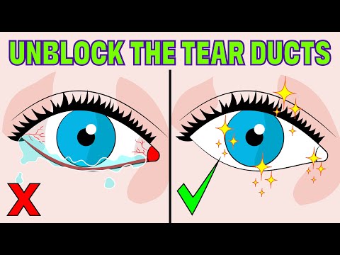 How to Fix a Blocked Tear Duct WITHOUT having Surgery!