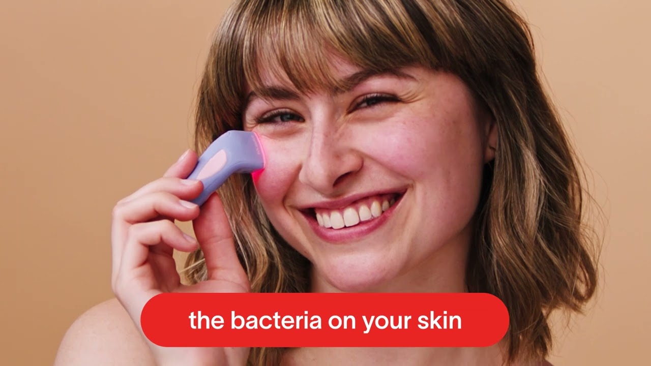 Solawave - Bye Acne Light Therapy Spot Treatment