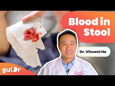 There’s Blood in My Poo, Is It Serious? | GutDr Q&A