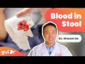 There S Blood In My Poo Is It Serious GutDr Q A