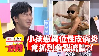 小孩罹患「異位性皮膚炎」，竟抓到龜裂流膿？！【#醫師好辣】20211110 part4 EP1233 蔣萬安 柯有倫