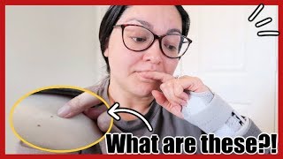 Red "spots" on my skin + the pain is BACK!
