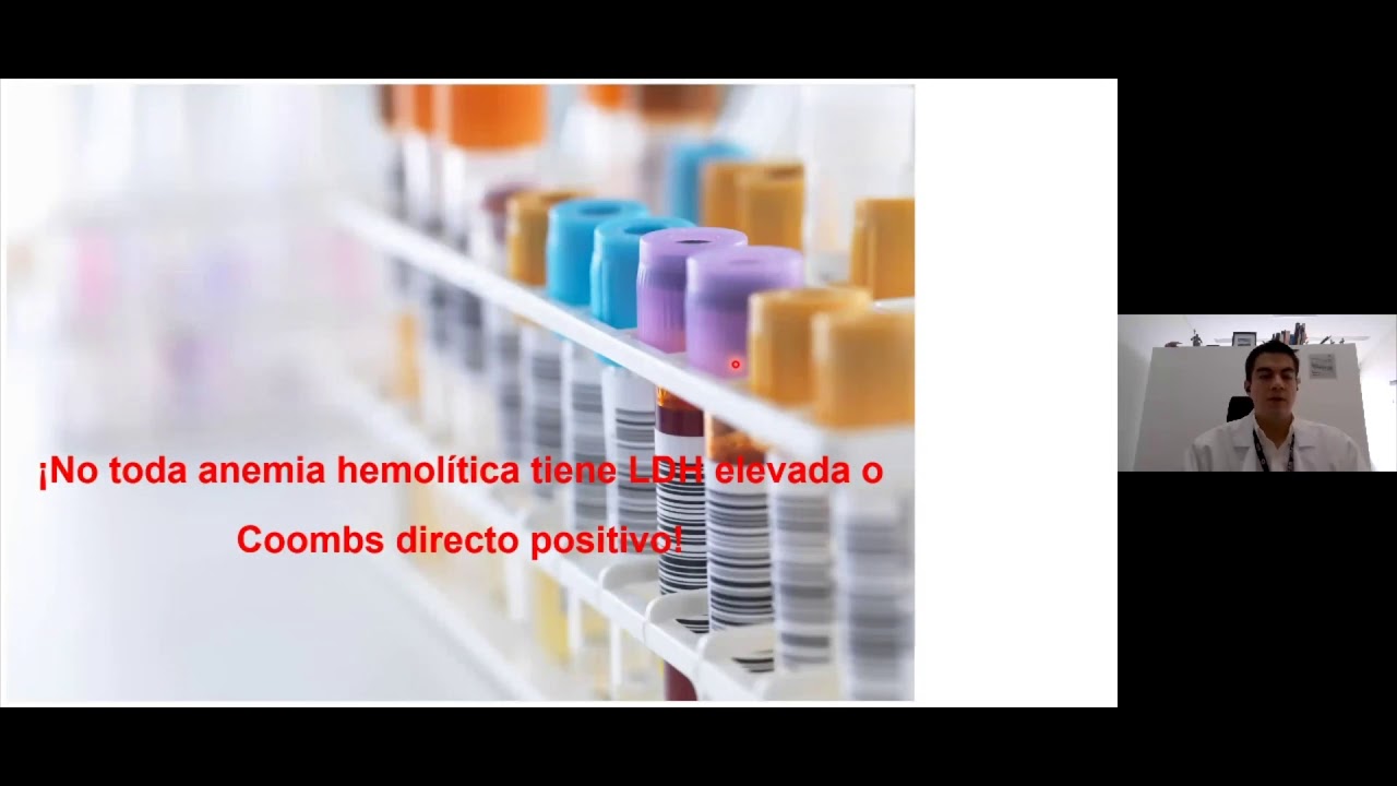 Lupus Lili: Aspectos prácticos para el manejo de pacientes de alta complejidad con (LES)