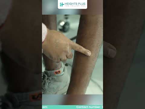 Heights Plus Patient Success Story YouTube Short Cover
