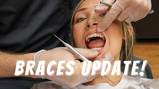 BRACES UPDATE 2022 | Adult With Braces